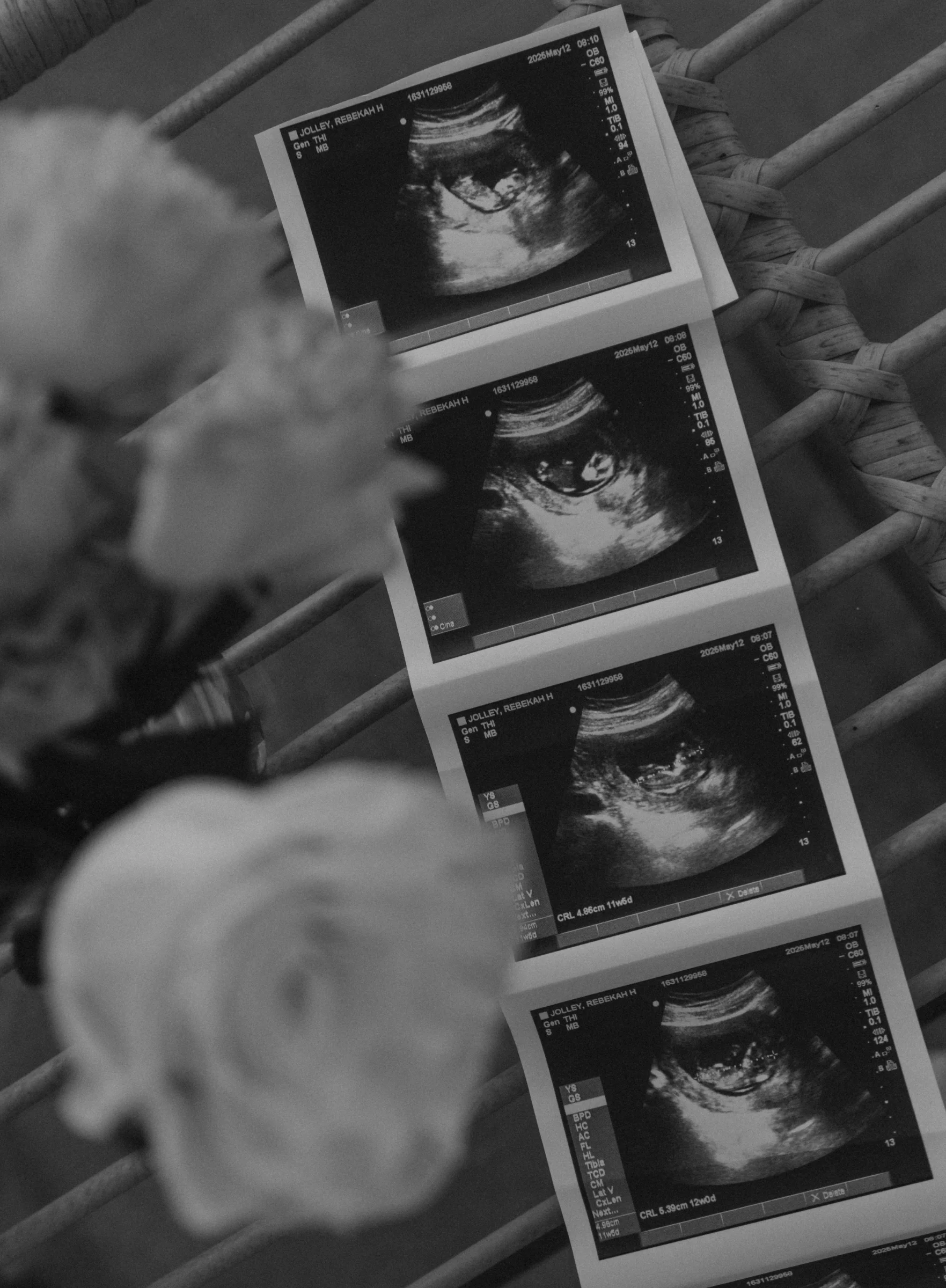 Jolley Maternity Shoot